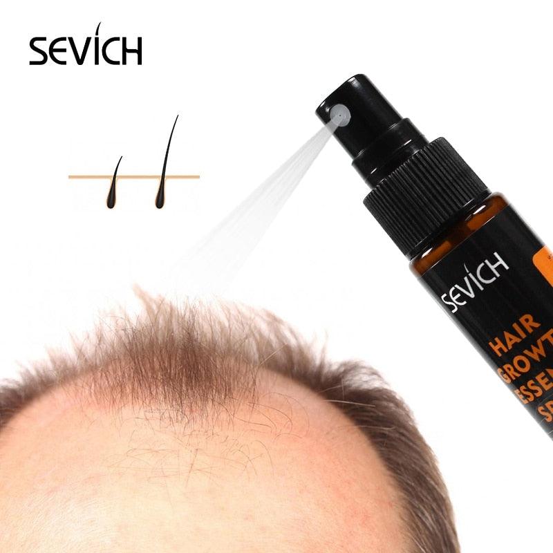 Herbal Oil Essence Fast Hair Growth Spray Hair Loss Treatment Help for hair Growth Hair Care-Shalav5
