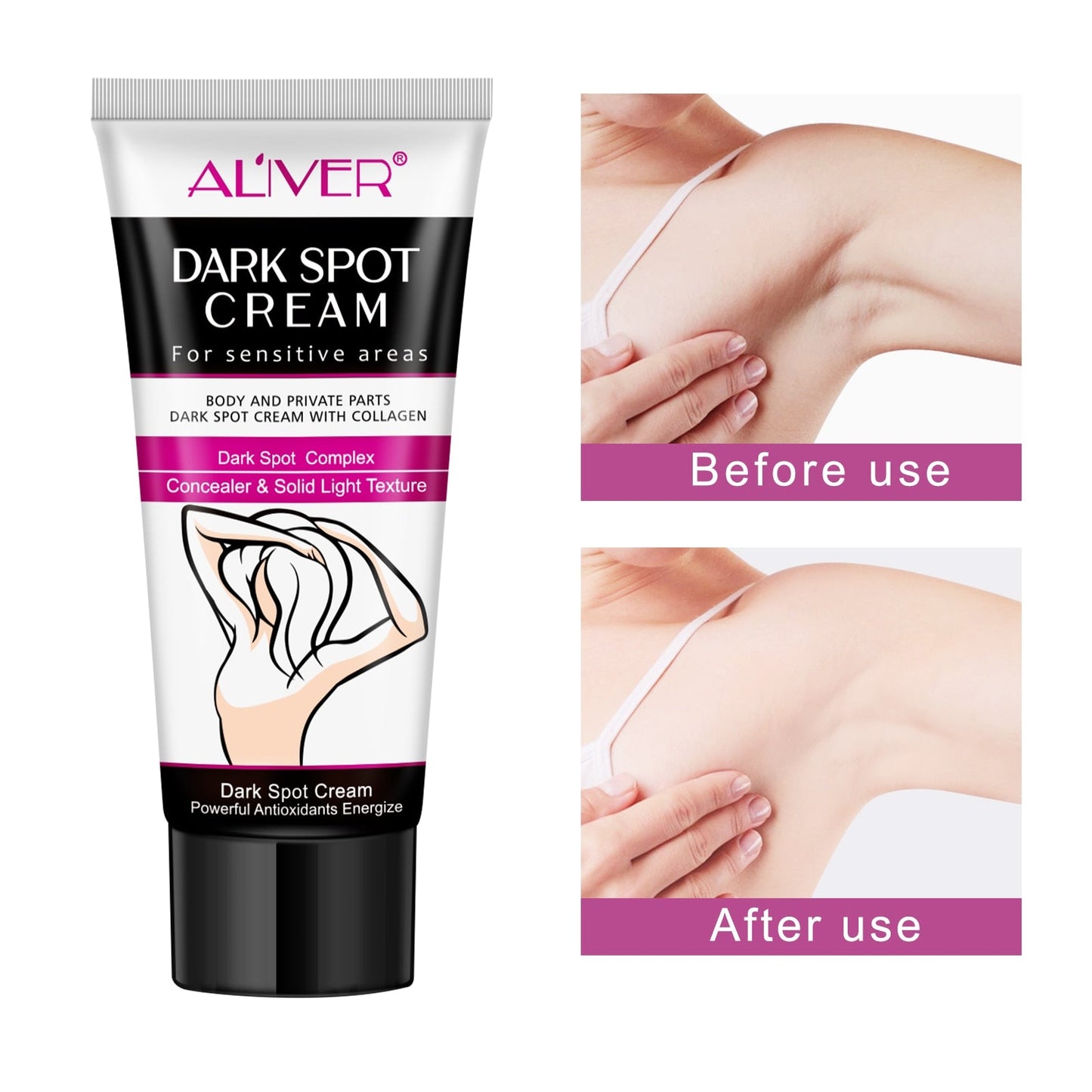 Body Whitening Cream Underarm Legs Bleaching Dark Skin-Shalav5
