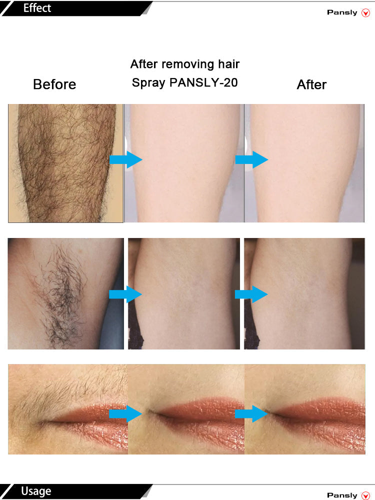 2 In 1 Inhibitor Silky Hair Removal Spray - Smooth Repair Skin 2 In 1 Inhibitor Silky Hair Removal Spray
